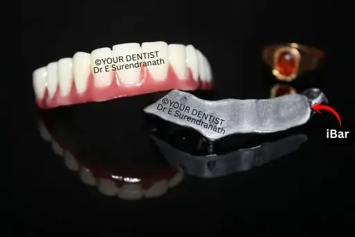 iBar zirconia teeth with a custom titanium bar for full mouth dental implant restoration in Vijayawada, how iBar Zirconia Teeth are made vijayawada