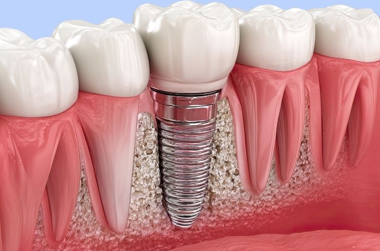 Your Dentist Dental Hospital