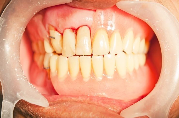 Your Dentist Dental Hospital