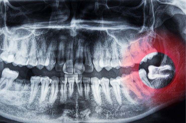 Your Dentist Dental Hospital