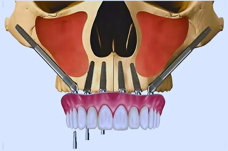 Your Dentist Dental Hospital