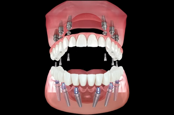 Your Dentist Dental Hospital