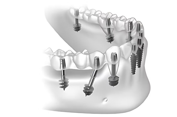 Your Dentist Dental Hospital