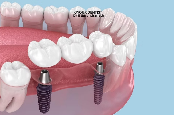 Your Dentist Dental Hospital