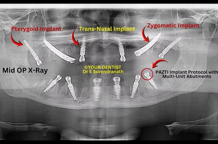 Your Dentist Dental Hospital