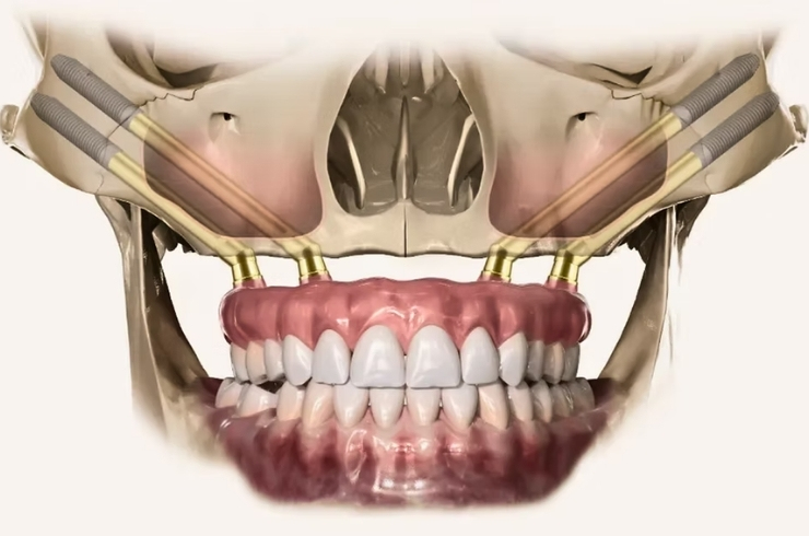 Your Dentist Dental Hospital